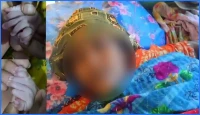 ৩০ আঙুল ও জিহ্বাবিহীন বিরল শিশুর জন্ম, এলাকায় চাঞ্চল্য